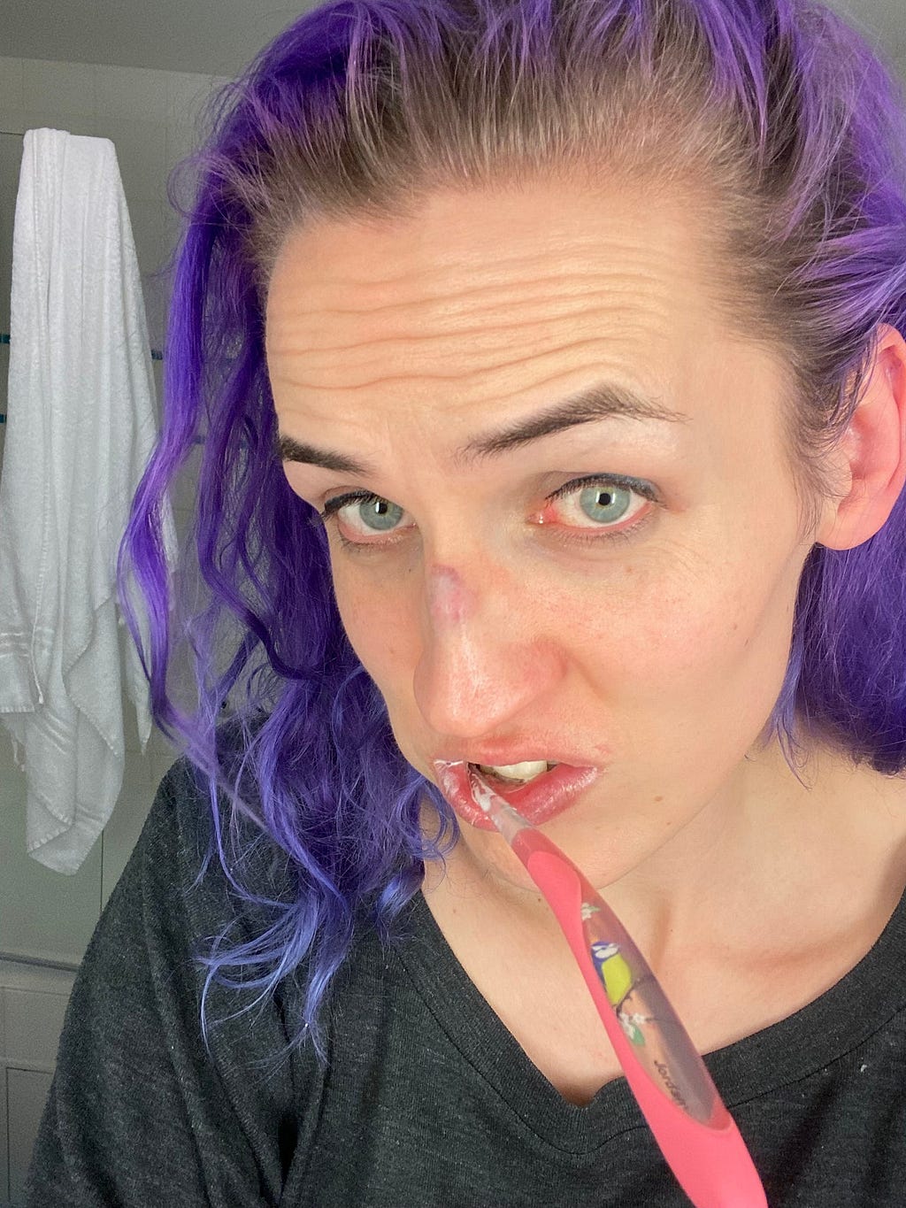 Selfie with toothbrush in mouth and bruise on nose as described in main text.