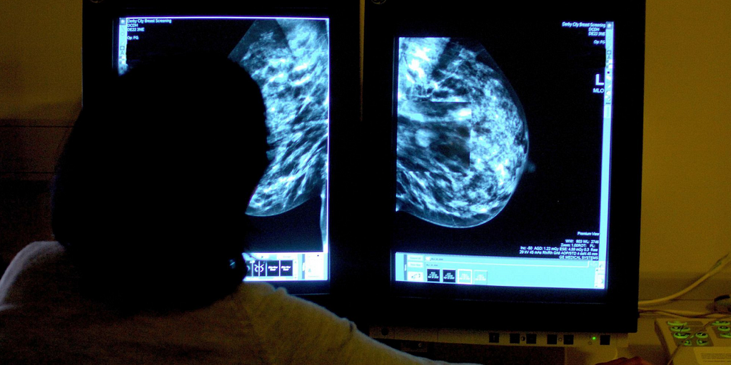 Friday Five: The bots fighting breast cancer image