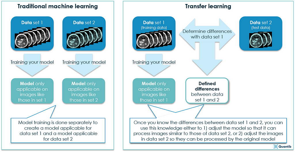 a schematic explanation of transfer learning in radiology AI