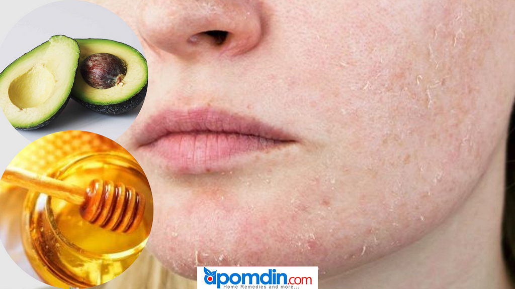 At home remedies for dry skin on face