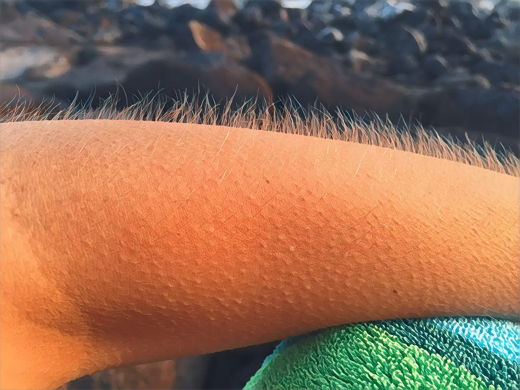 A girl with goosebumps on her arms and hair standing on end