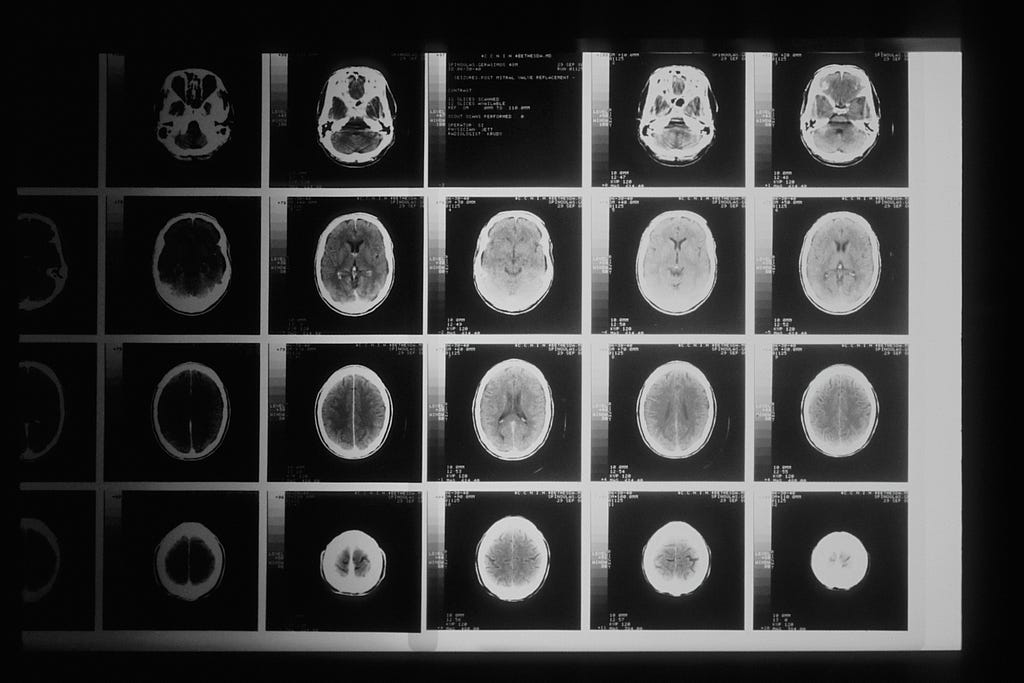 Unusual Experiments on human brain stimulation