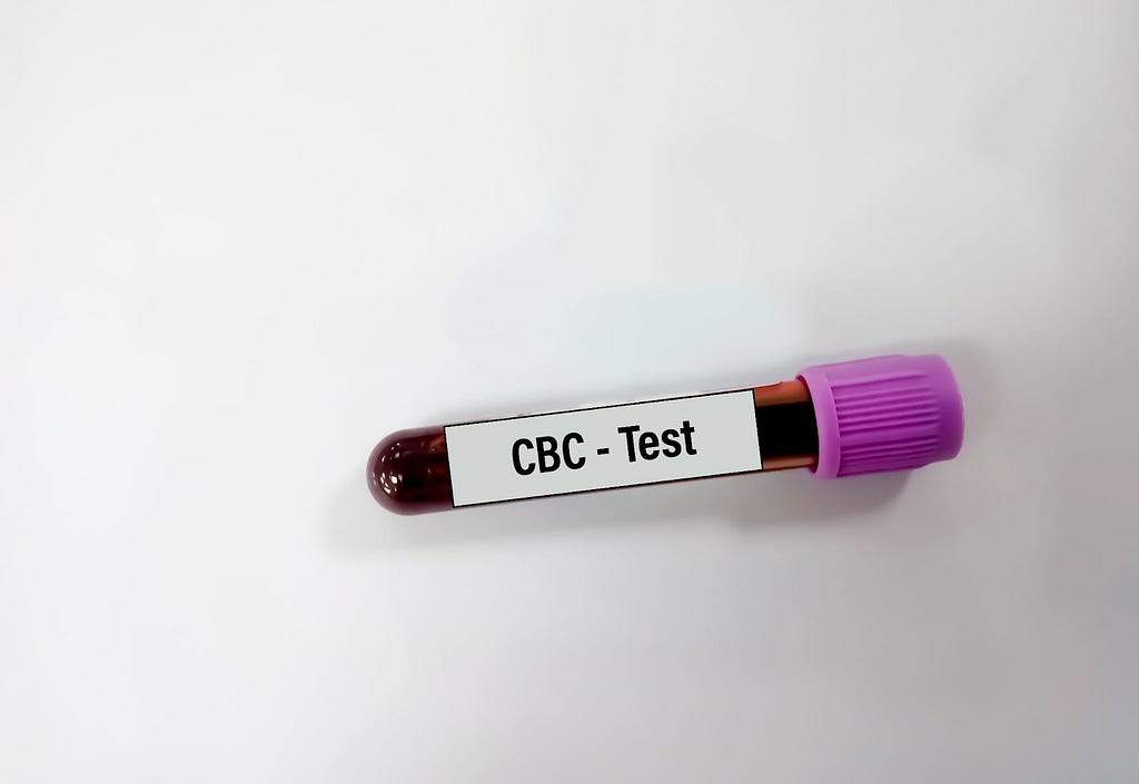 A vial of blood sample with “CBC- Test” printed on it.
