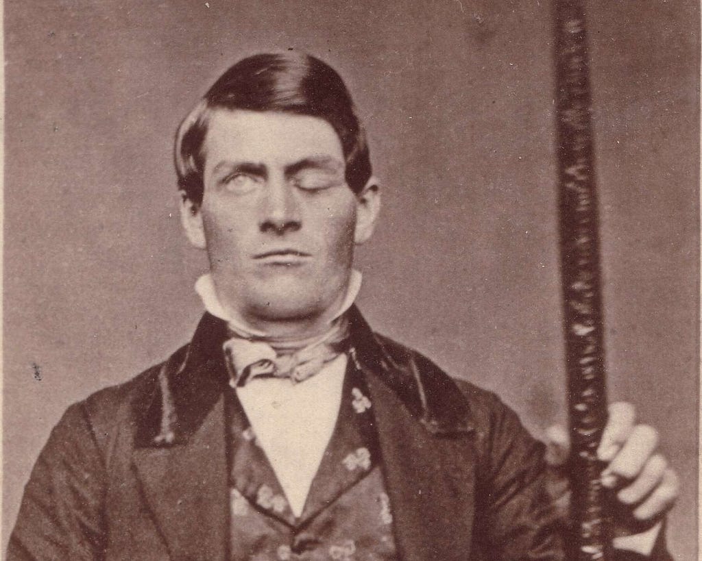 Phineas Gage