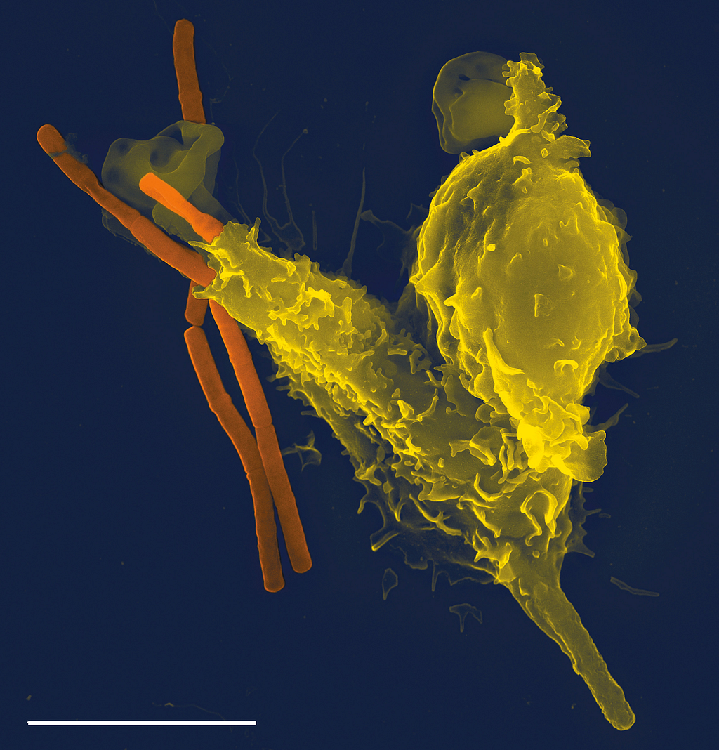 A scanning electron microscope image of a single neutrophil (yellow), engulfing anthrax bacteria (orange)