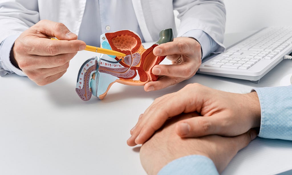 Doctor demonstrating the tumour in prostrate gland