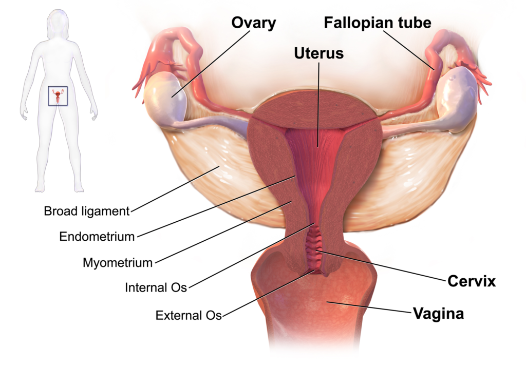 PCOS