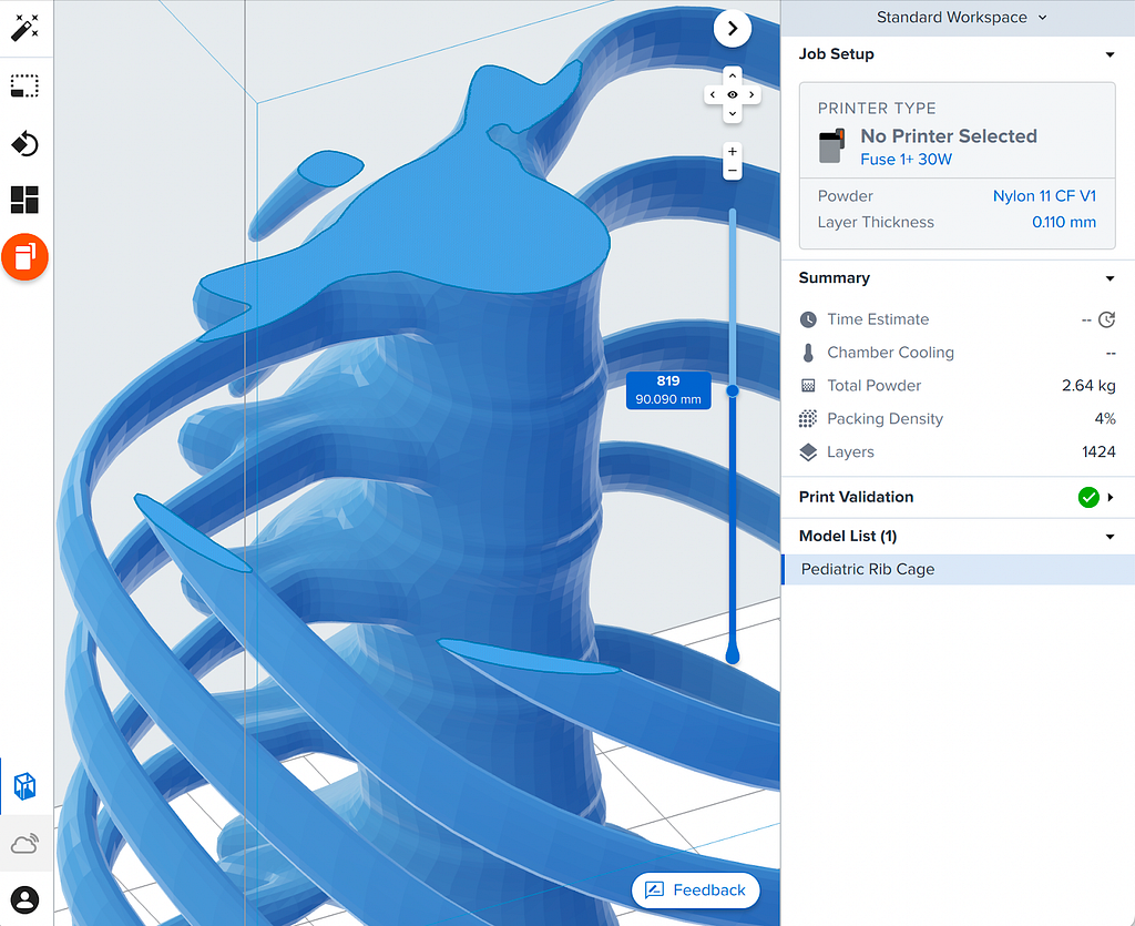 Screenshot of PreForm showing a 3D model of a rib cage, slicing a layer part way through the print.