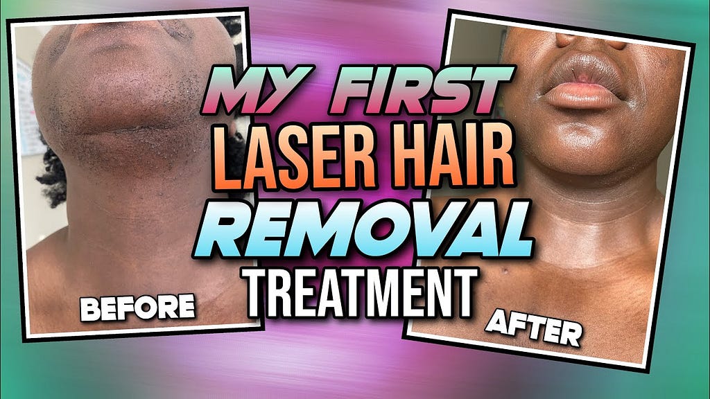 Ideal Laser Hair Removal Reviews: Unbiased Insights & Results