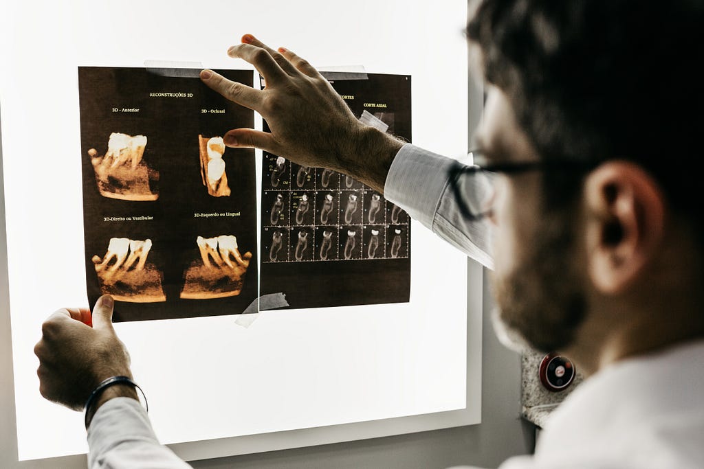 Doctor looking at resutls from an x-ray