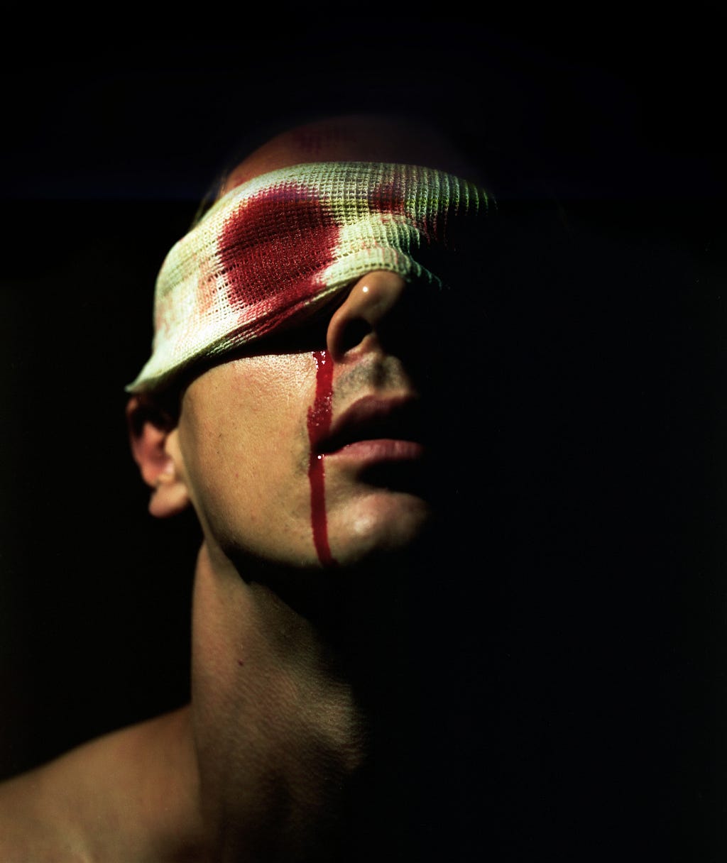 A man with bloody bandages on his eyes