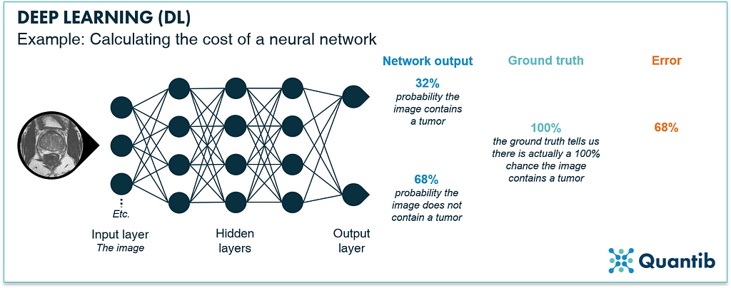 schematic figure illustrating deep learning in radiology explaining how to calculate the cost of a neural network