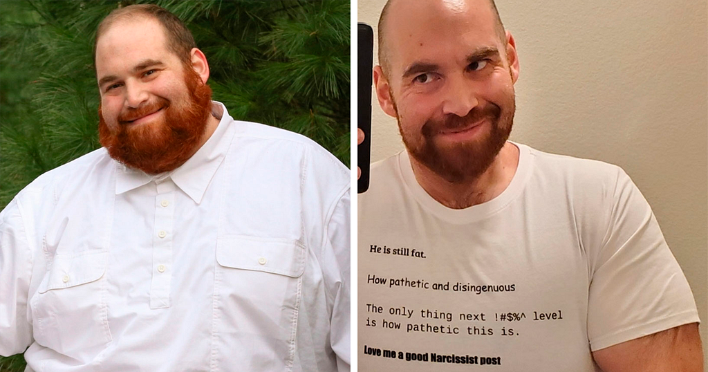 Haters Write Suggest Messages To A Man Who Misplaced Weight And Hit The Entrance Net web page Of Reddit, He Prints Them On A T-shirt And Hits Entrance Net web page As soon as extra