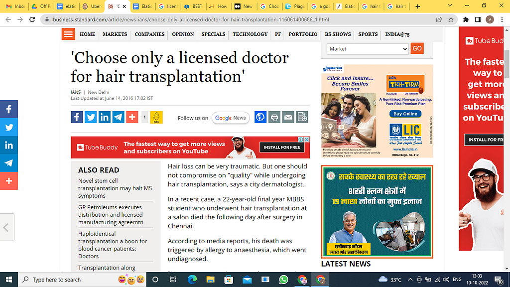news for choosing a licensed doctor for hair transplantation, Backlinks Vikas