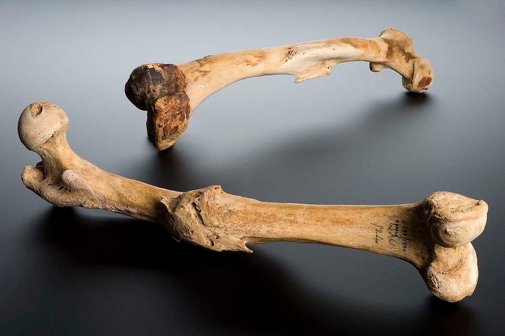 Human left femur, Tell Fara, Palestine, 100 BCE-200 CE source: wikipedia commons image.