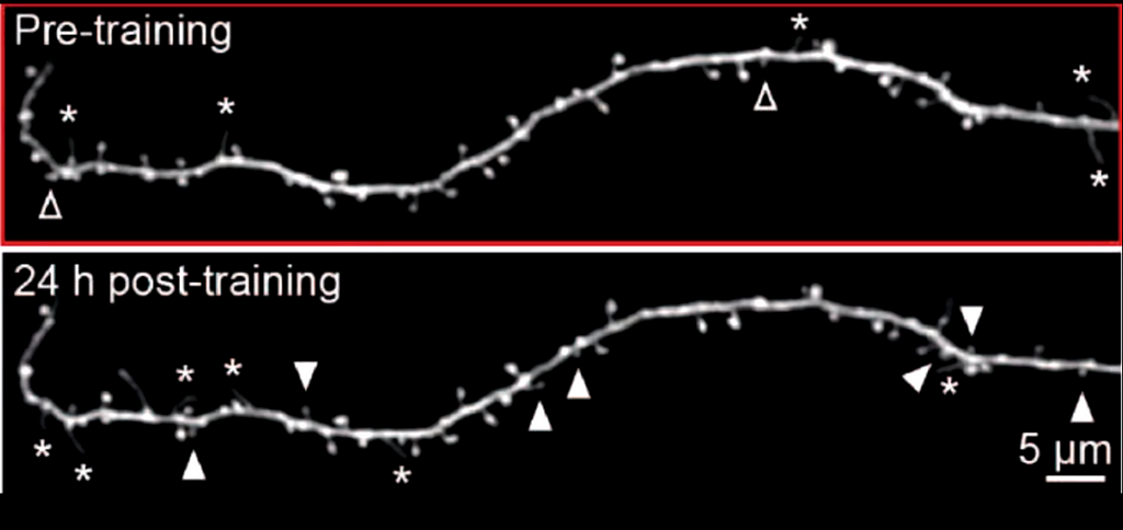 Multiple synapses that are newly formed together after training and sleep on the same dendrite are indicated by the white arrowheads.