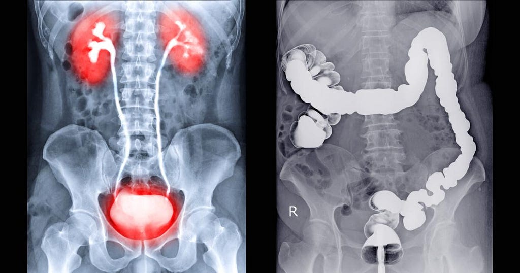 orally administer MRI contrast agent types for abdominal and gastrointestinal imaging.