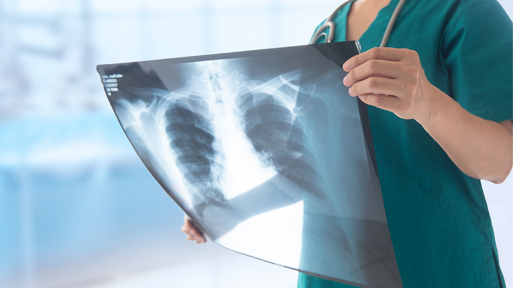 Un técnico de rayos X examina una radiografía