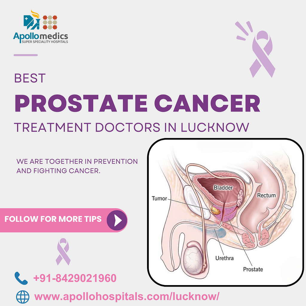 Best Prostate Cancer Treatment Doctors in Lucknow