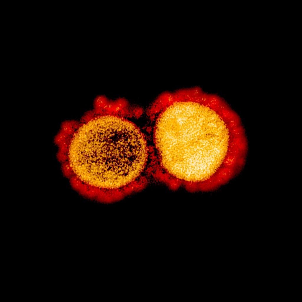 Transmission electron micrograph of SARS-CoV-2 virus particles, isolated from a patient. Image captured and color-enhanced at