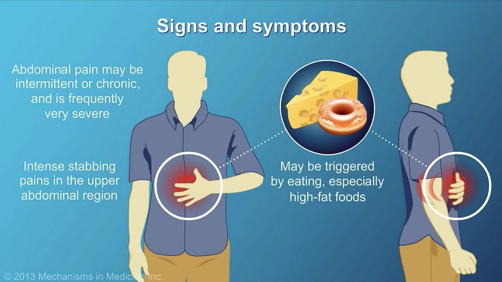 7 symptoms of pancreas problems