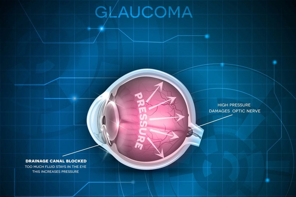 What is glaucoma?