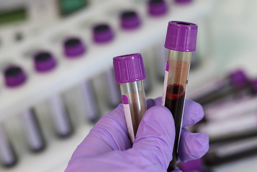 Tubos de ensaio contento sangue a ser analisado.