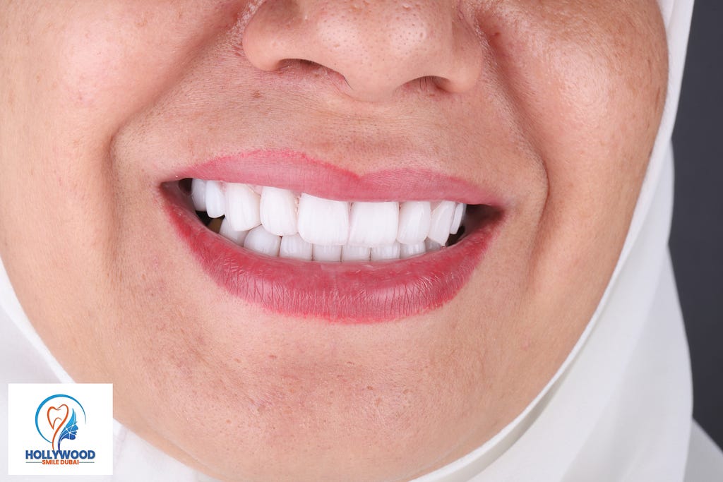 Best Dental Clinic For Smile Makeover In Dubai