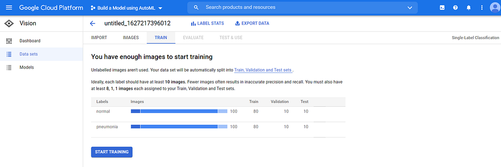 Screenshot of Google’s AutoML Vision platform showing class distribution for Normal and Pneumonia classes. 80% of the data is for training, 10% is for testing, and 10% is for validation.