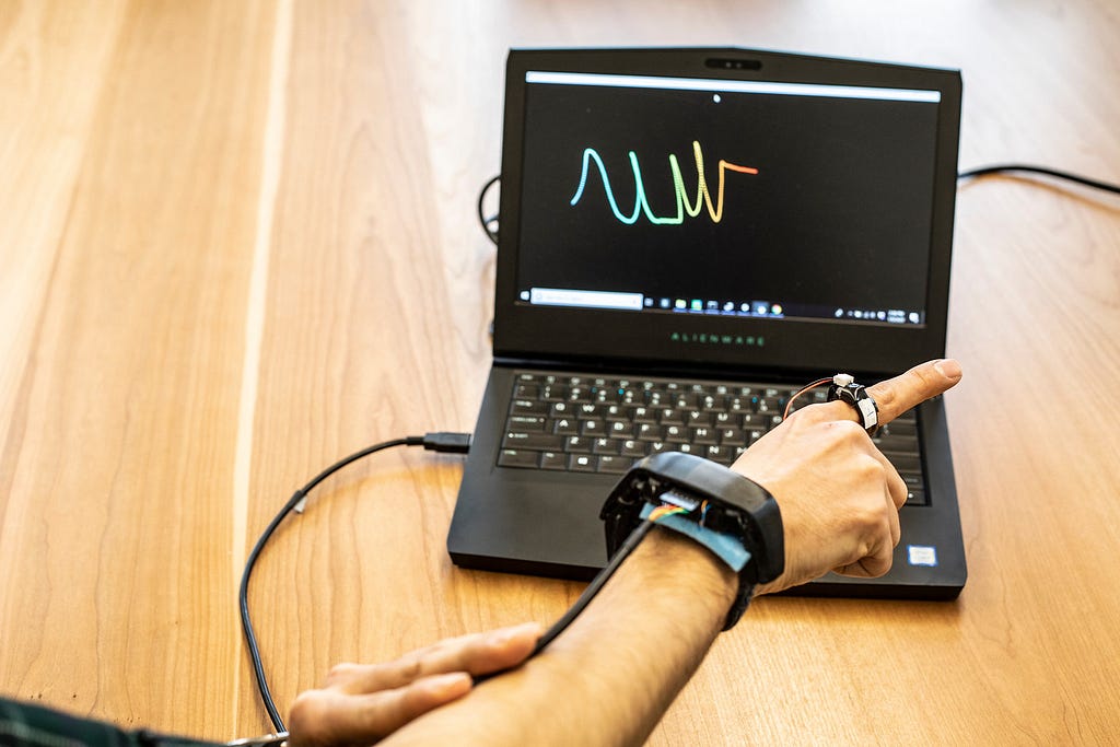 Image of a hand with a ring, bracelet, and wires connected to a laptop graphing hand movements.