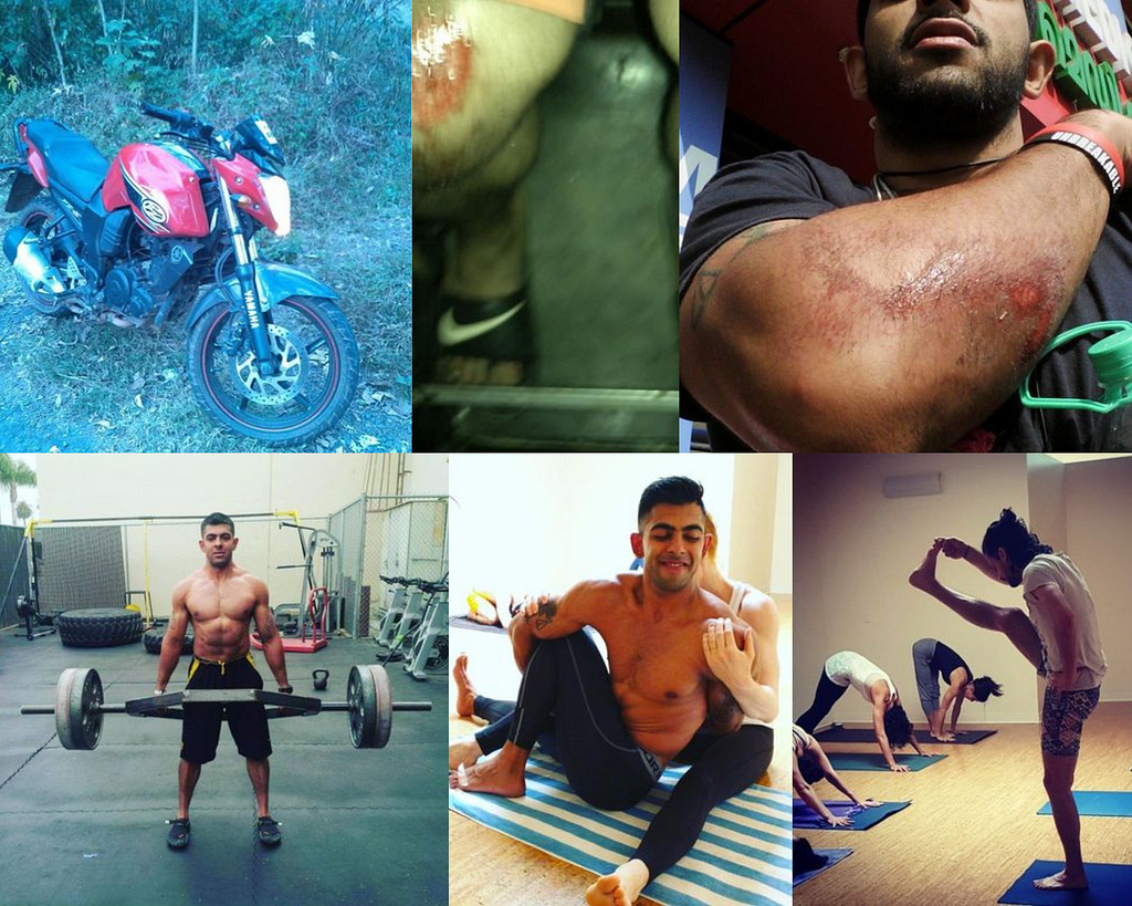 Photos from the bike accidents, practicing traditional yoga and weightlifting exercises that made injuries worse.