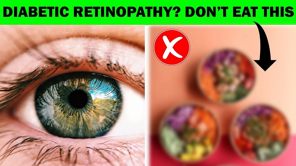 Diabetic Retinopathy | 5 Healthy Food You Should Eat and Avoid