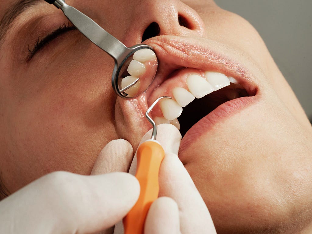 Iqaluit Dental Clinic image of a person getting a dental checkup