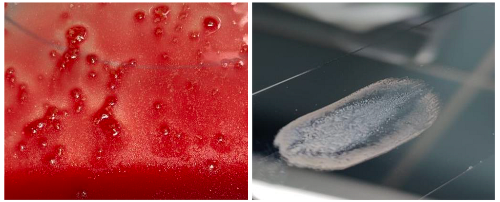 Basics & Orientation — What exactly are bone marrow diagnostics? Part 1
