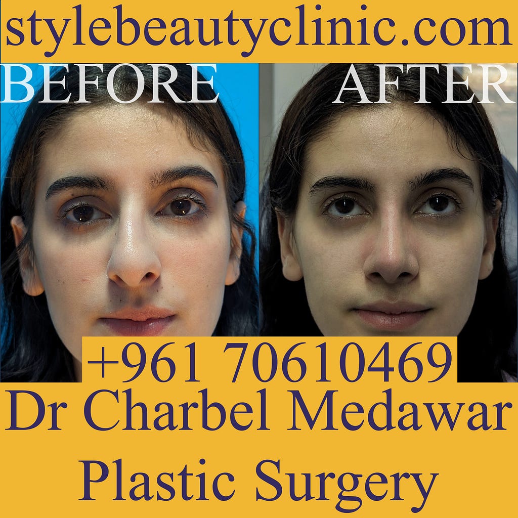 top rhinoplasty surgeon lebanon dr charbel medawar