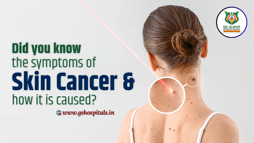 Did you know the symptoms of Skin Cancer & how it is caused?