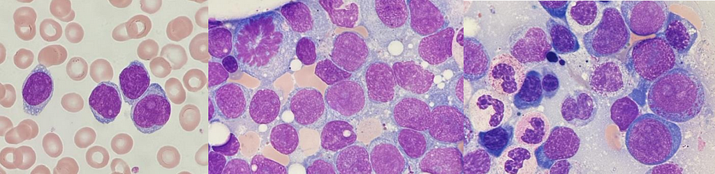 Colorful Hematology: How stains reveal cellular morphology