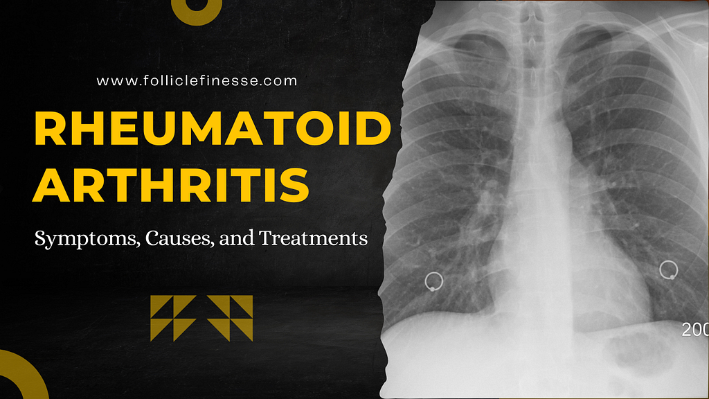 Rheumatoid Arthritis, health tips, health issues