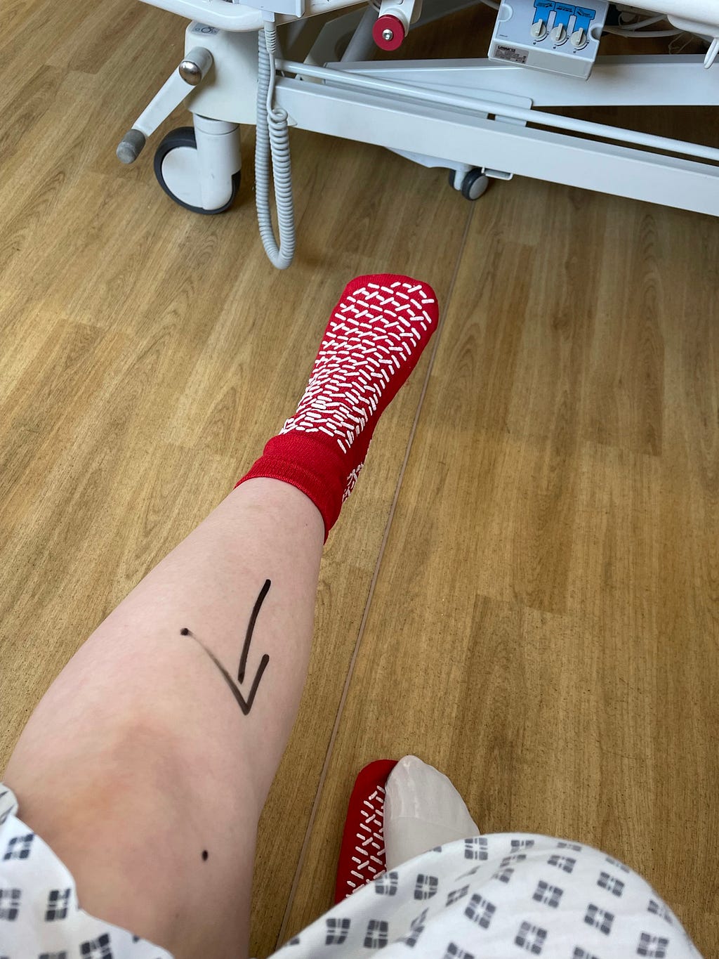 An image of the author’s left leg with an arrow drawn in marker pointing to the left knee. The author is white and wearing a red hospital non-slip sock.