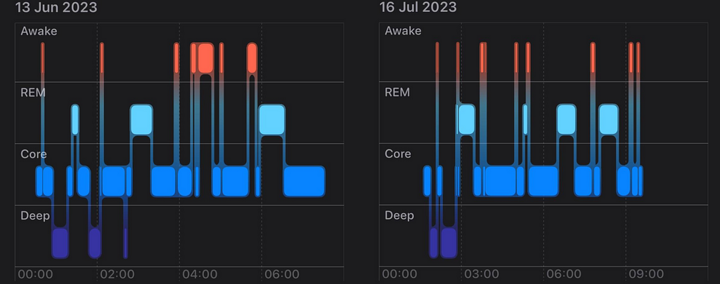 Apple watch’s sleep tracker screenshot, showing I had multiple wake ups during the night and could fall back asleep fast