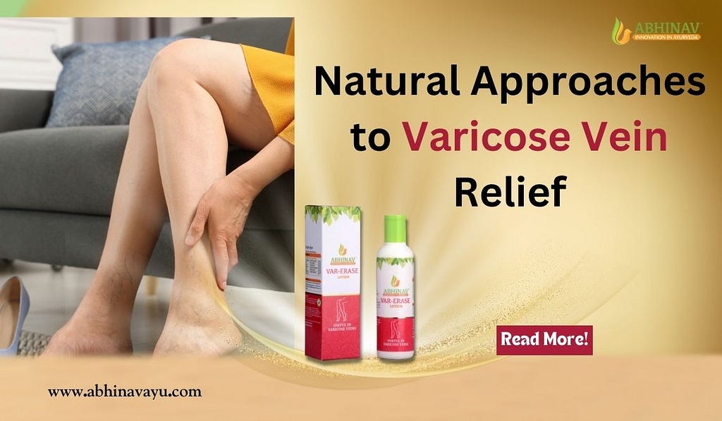 Natural product for varicose veins