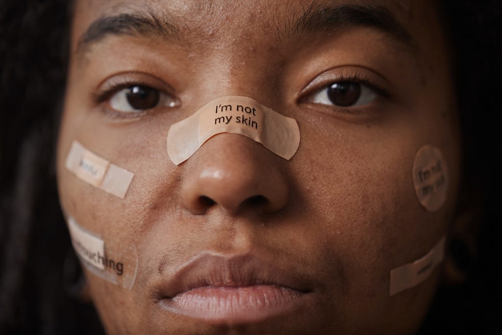 A girl with a plaster on the bandage on her nose, that reads, “I’m not my skin”