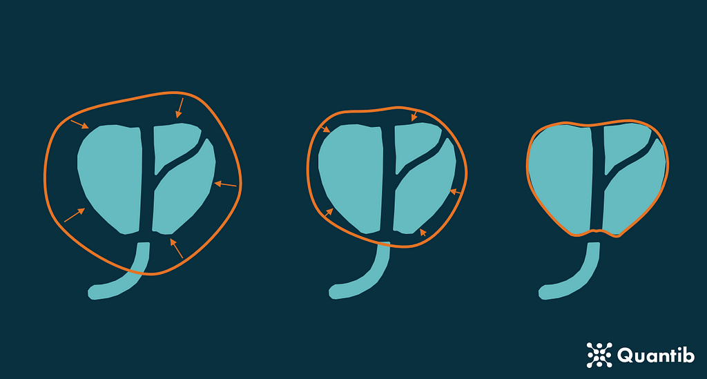 Deep learning for radiology volume measurements: an introduction to medical image segmentation