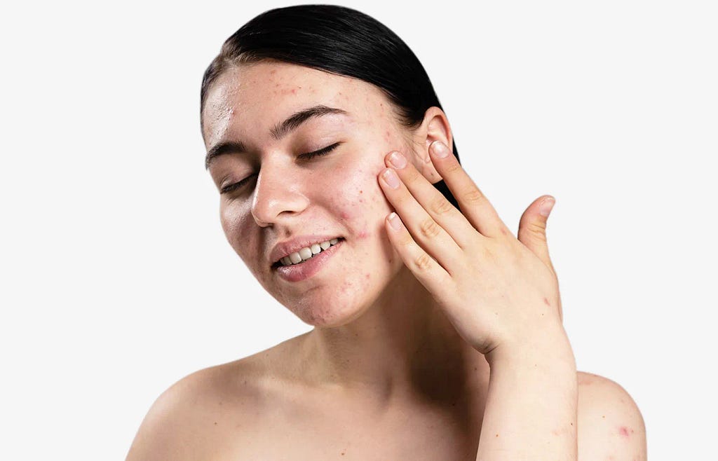 Urban Culture-Dos and Don’ts for Oily Acne-Prone Skin