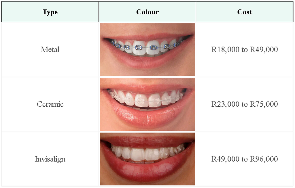 table with braces prices and images