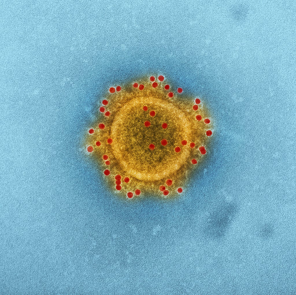 A single Middle East respiratory syndrome coronavirus with the envelope proteins in red (Photo by CDC on Unsplash licence)