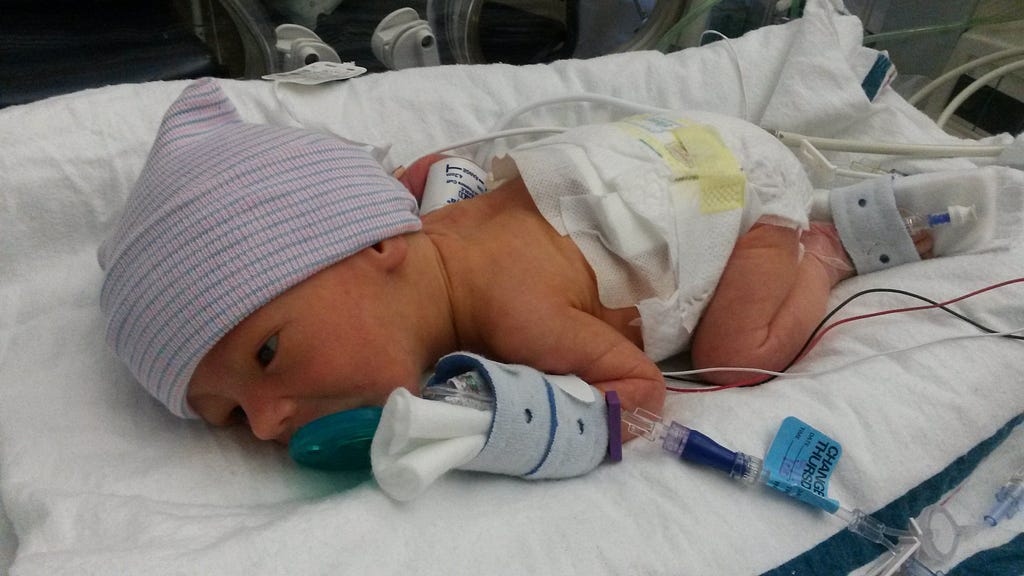 A newborn baby in the NICU with Spina Bifida laying on his belly with a pacificer in his mouth and a hospital cap on.