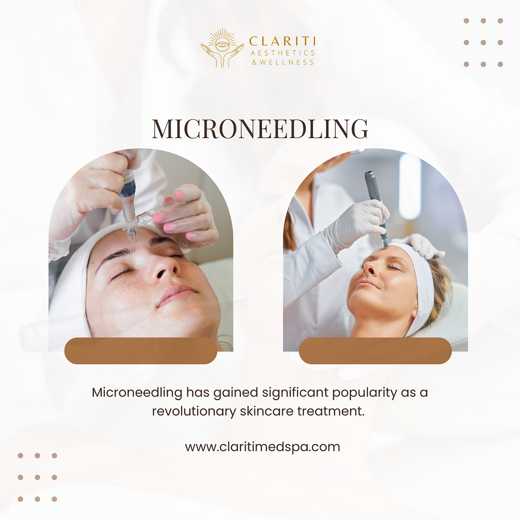 Microneedling in Houston, TX