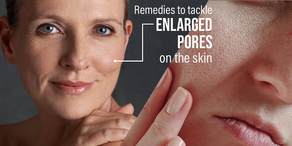 get rid of enlarged pores