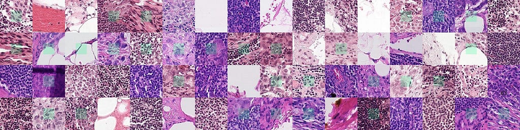 Histopathological Images from PCam.